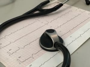 How to read ecgs faster