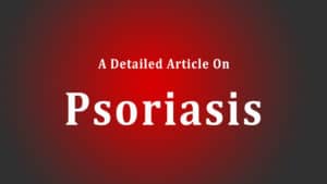 Read more about the article Psoriasis: In-Depth Discussion