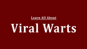 Viral warts