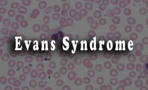 Read more about the article Evans Syndrome