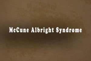 Read more about the article McCune Albright Syndrome