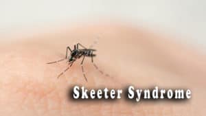 Read more about the article Skeeter Syndrome