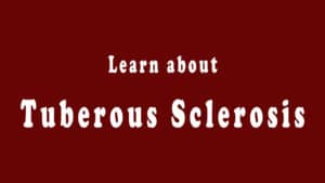 Read more about the article Tuberous Sclerosis