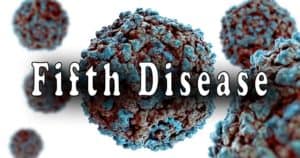 Read more about the article Fifth Disease