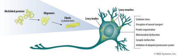 Lewy Body Dementia - Costamedic