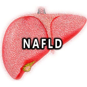 Read more about the article Non-Alcoholic Fatty Liver Disease (NAFLD)