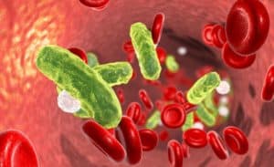Read more about the article Septicaemia (blood infection) – Causes, Symptoms, and Treatments