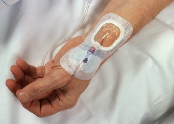 Catheter-related bloodstream infection – CRBSI - Costamedic