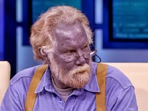 Read more about the article What is Blue Man Syndrome?
