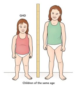 Read more about the article Growth Hormone Deficiency