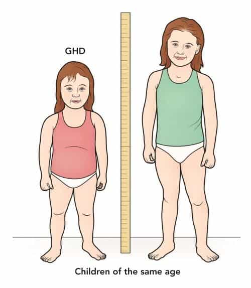 Growth Hormone Deficiency Costamedic