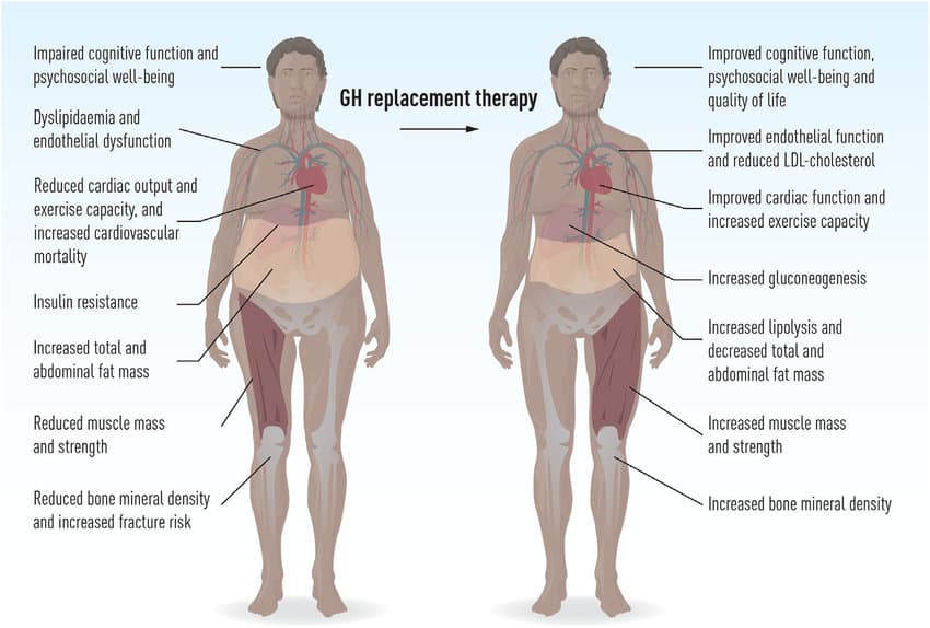 Growth hormone replacement therapy