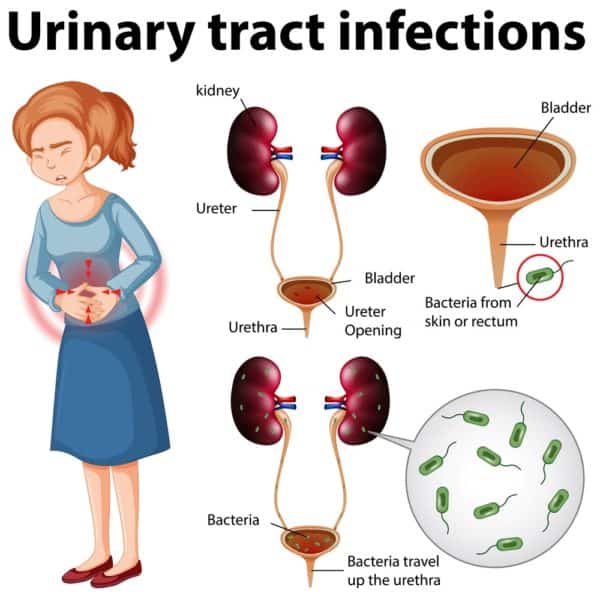 Urinary Tract Infection Uti Symptoms Diagnosis And Treatment Costamedic 0016