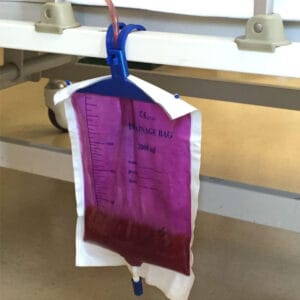 Read more about the article Purple Urine Bag Syndrome