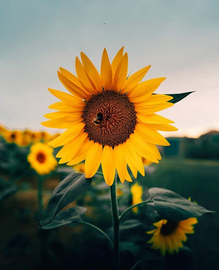 Sunflower syndrome