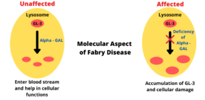 Read more about the article Anderson-Fabry disease